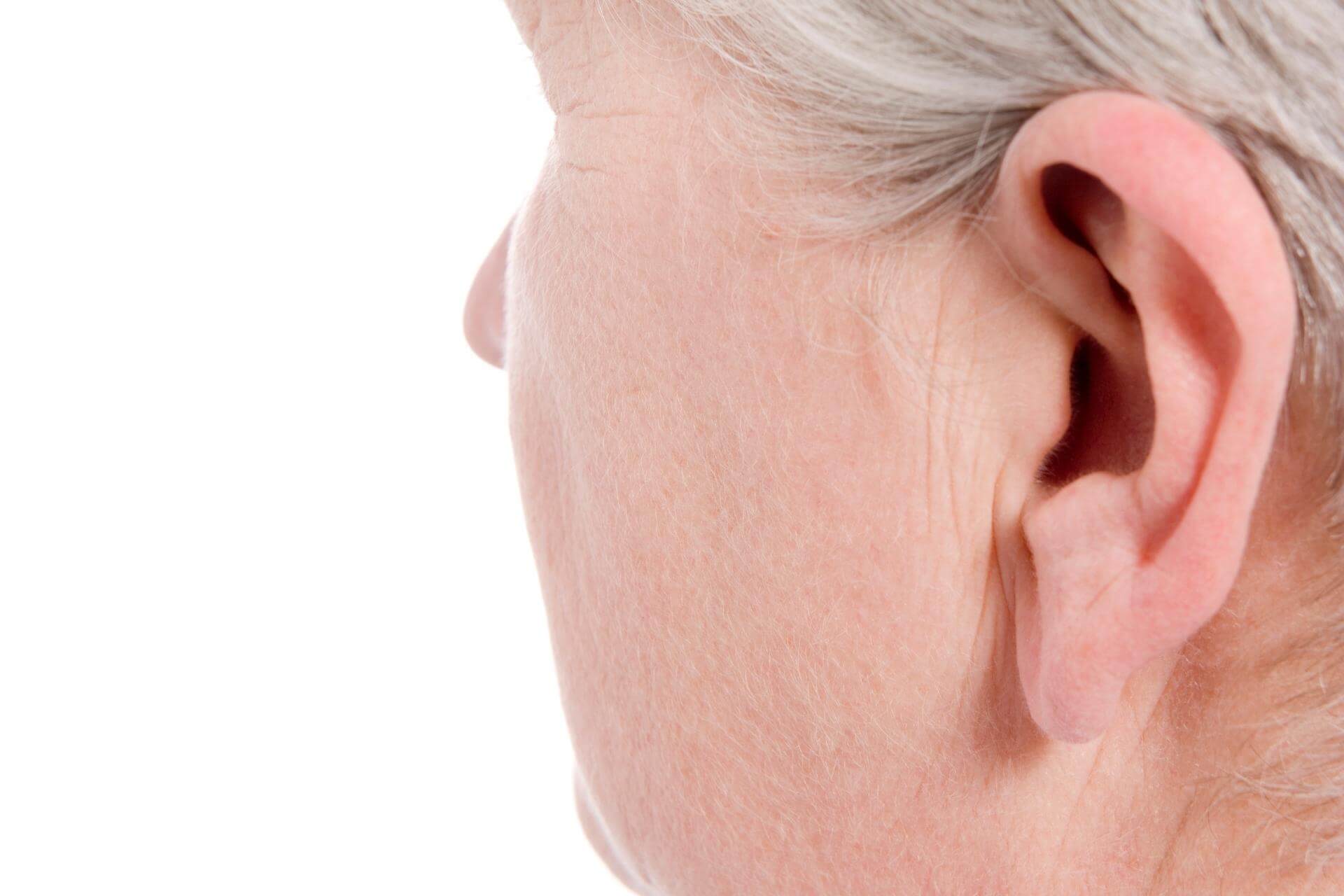 correzione lobi orecchie allungati