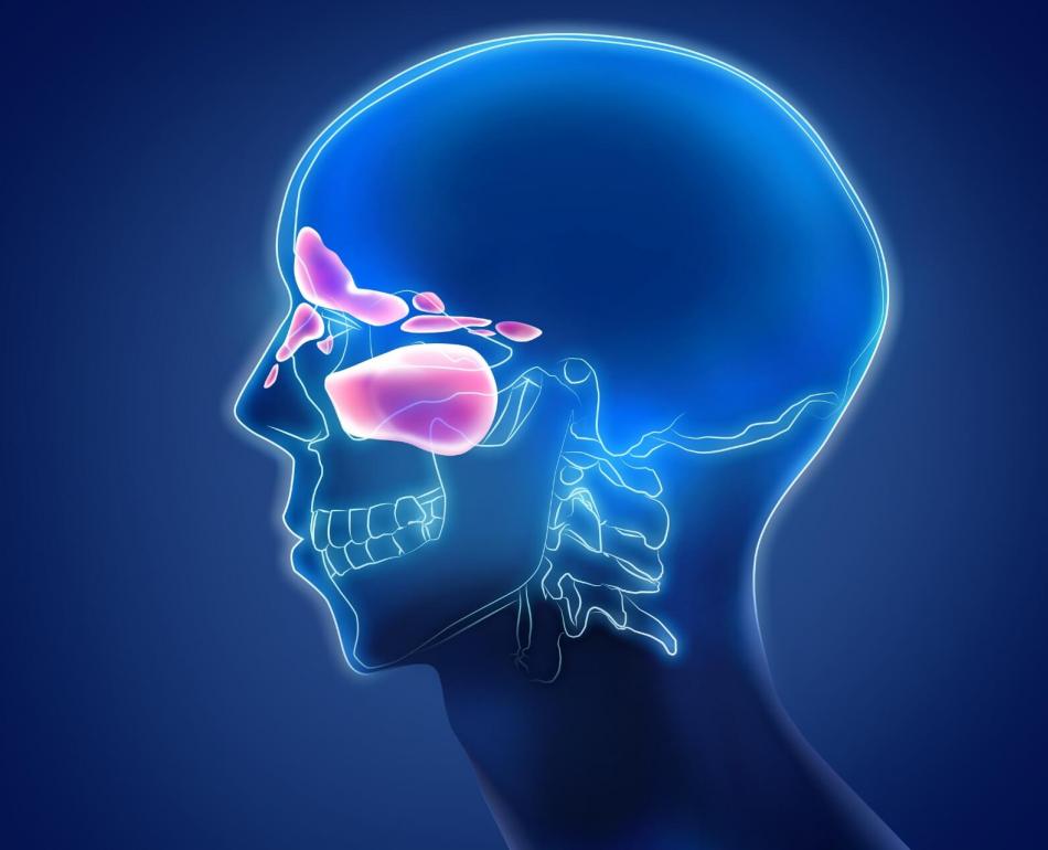 sinusite cronica: quali zone colpisce